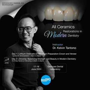 All Ceramics Restorations in Modern Dentistry