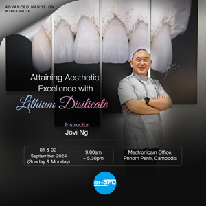 Attaining Aesthetic Excellence with Lithium Disilicate